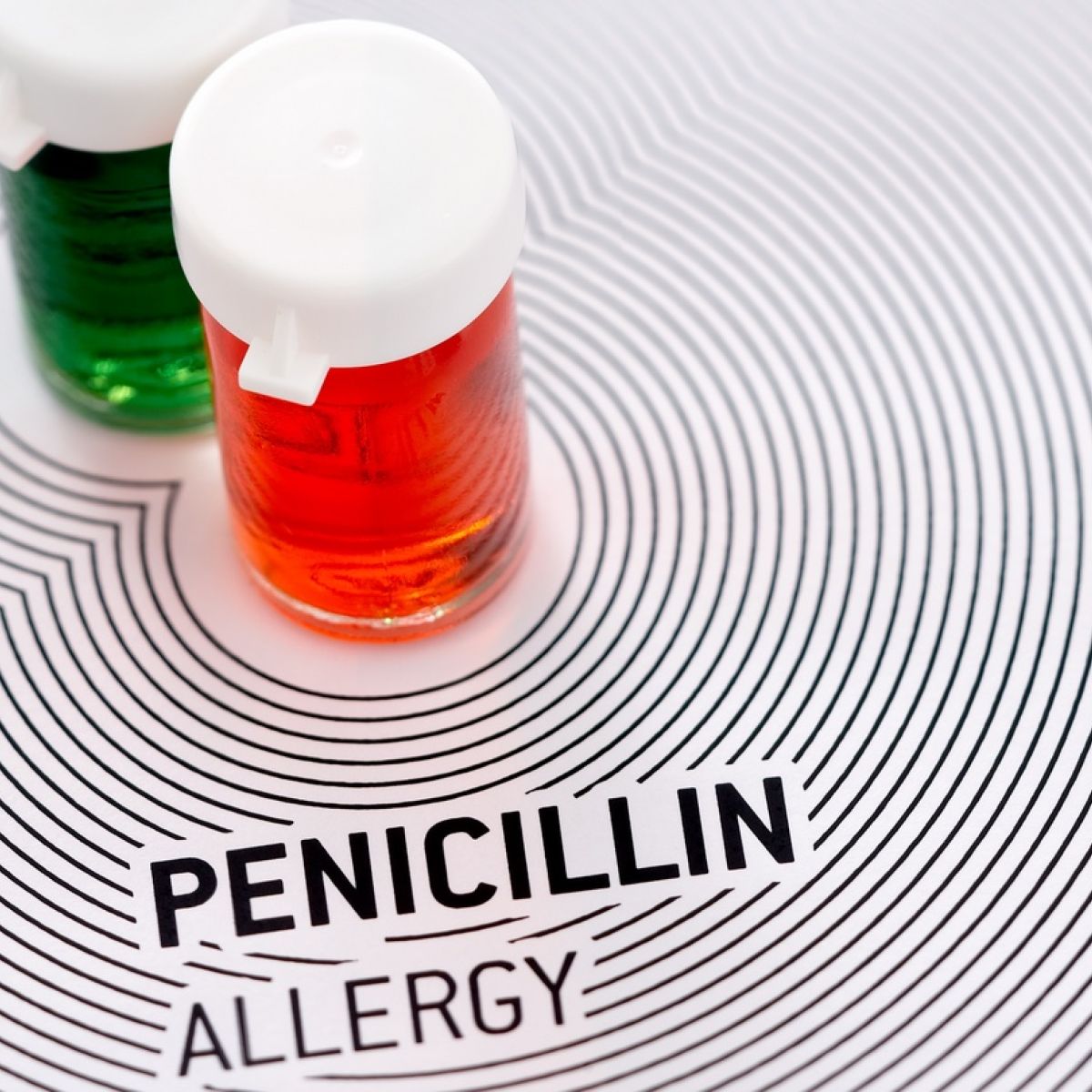 Untrue penicillin allergies and de-labelling spurious antibiotic allergy labels to combat AMR