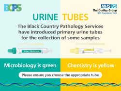 New urine tubes to be introduced from 1 February